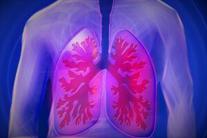 příznaky rakoviny plic