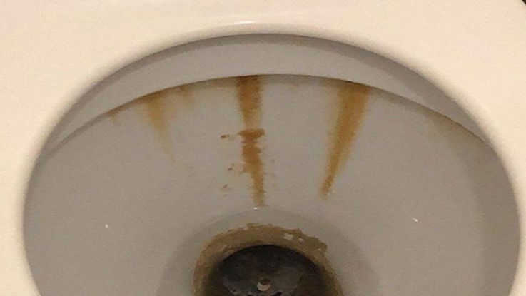 jak vycistit toaletu a vratit ji bilou barvu bez pouziti chemickych prostredku je to mozne Jak vyčistit toaletu a vrátit jí bílou barvu. Bez použití chemických prostředků je to možné